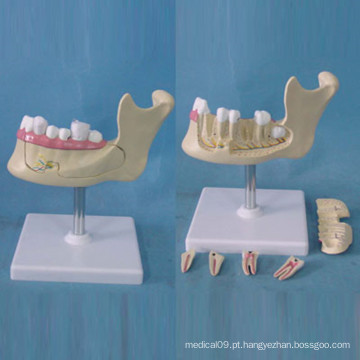 Estrutura de localização do dente humano Modelo de anatomia para o ensino (R080113)